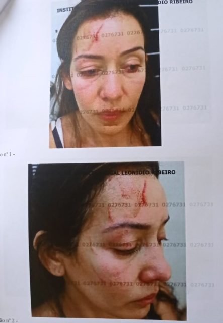 Fotos mostram como ficou vítima de violência