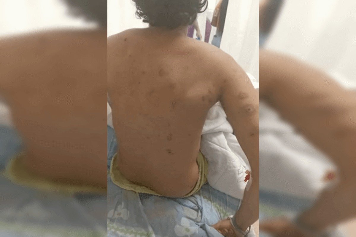 Israel: brasileiro ferido foi atingido por estilhaços de granada |  Metrópoles