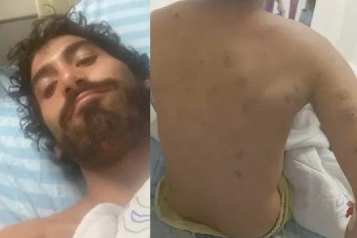 foto colorida de brasileiro hospitalizado após ataque em Israel - Metrópoles