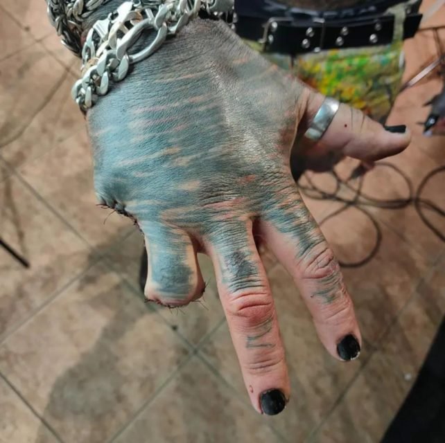 Mão de homem tatuada e com unhas pintadas de preto; dedos mínimo e anelar foram removidos - Metrópoles