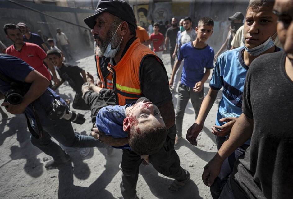 Criança coberta de sangue é socorrida após ser retirada dos escombros na cidade de Khan Yunis, Gaza - Metrópoles