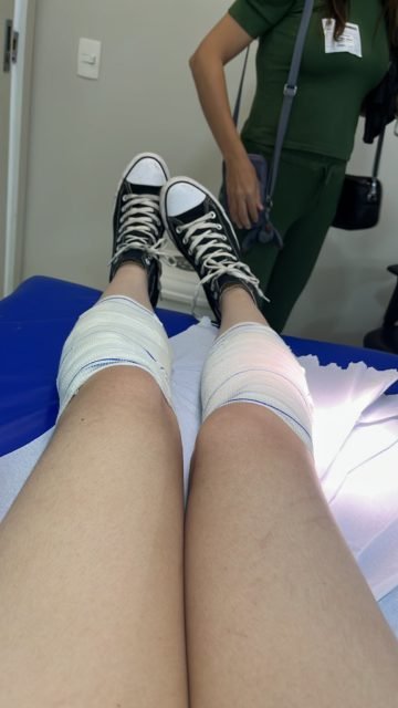 Fã de Taylor Swift no hospital após sofrer queimaduras nas pernas - Metrópoles