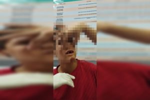 Agressão adolescente autista