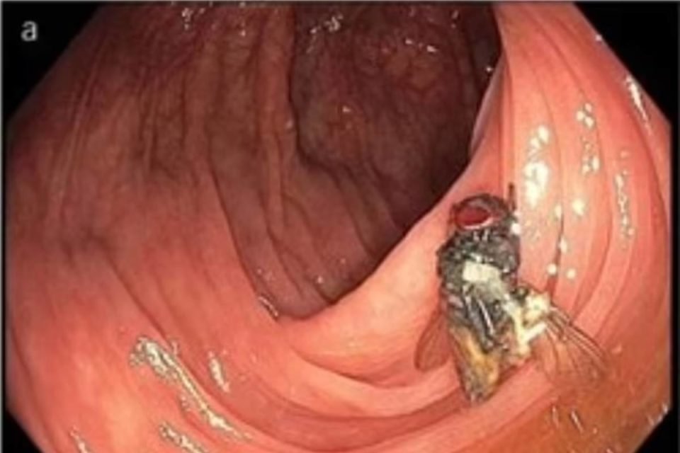 Imagem colorida de mosca viva dentro de intestino - Metrópoles