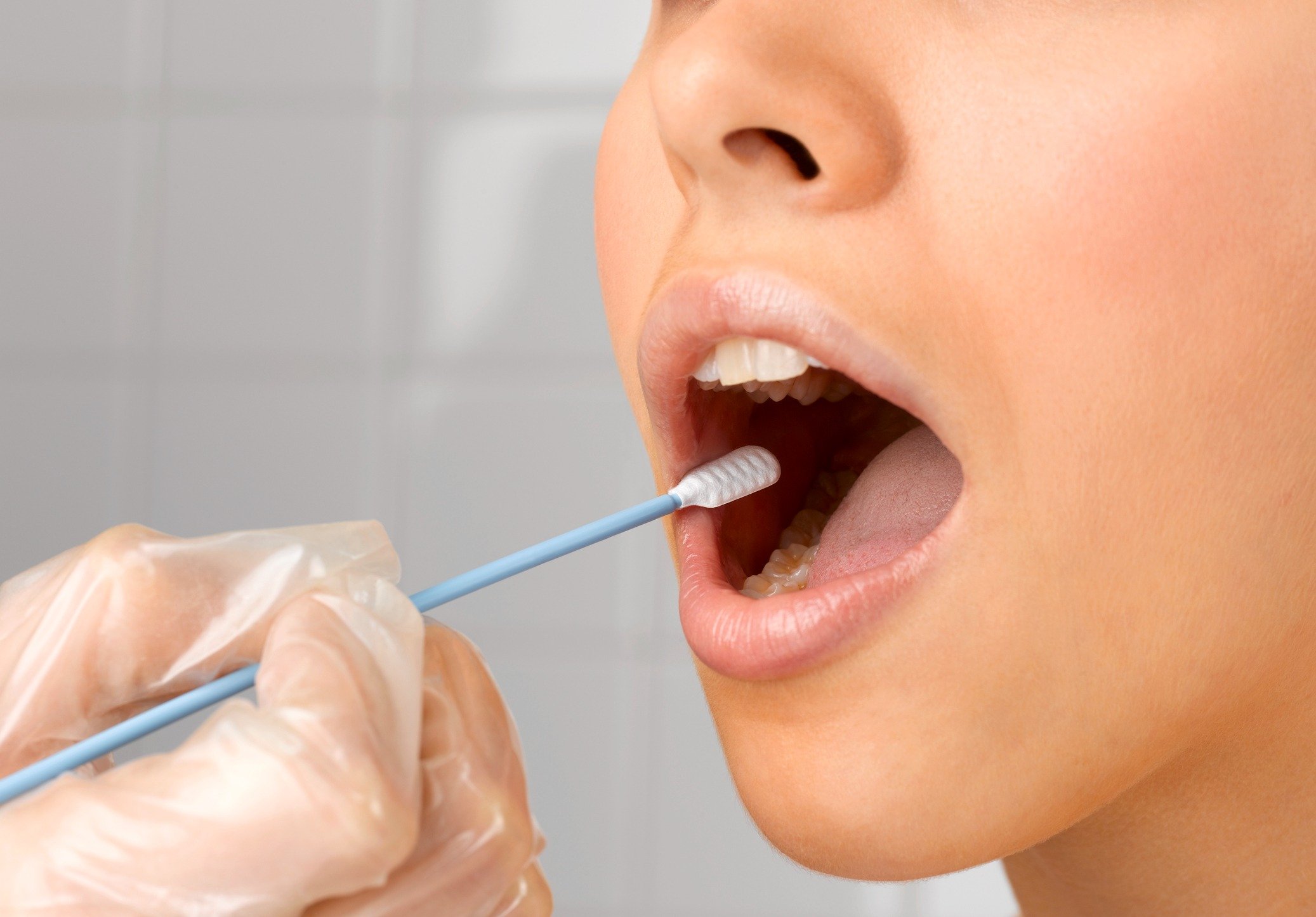 Foto mostra teste de saliva sendo realizado na boca de mulher com um cotonete largo - Metrópoles - DNA açúcar câncer