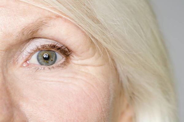 Foto colorida em close do rosto de uma mulher idosa com rugas, o cabelo loiro e o olho verde - Metrópoles