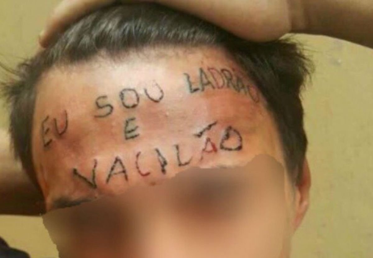 Imagem colorida mostra Ruan Rocha da Silva teve a testa tatuada em 2017 com a frase "sou ladrão e vacilão" - Metrópoles