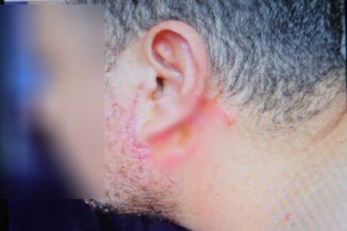 Dentista é presa por deformar rosto de pacientes