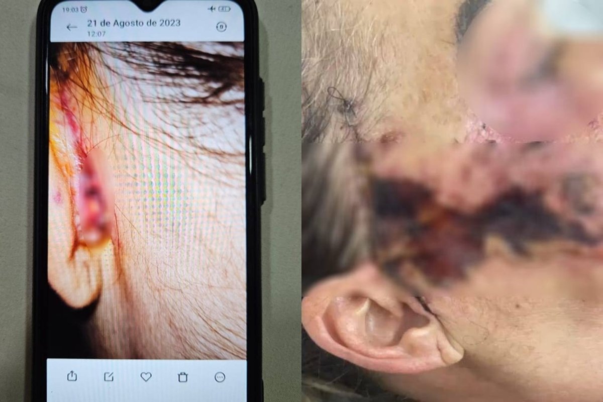 Dentista é presa por deformar rosto de pacientes