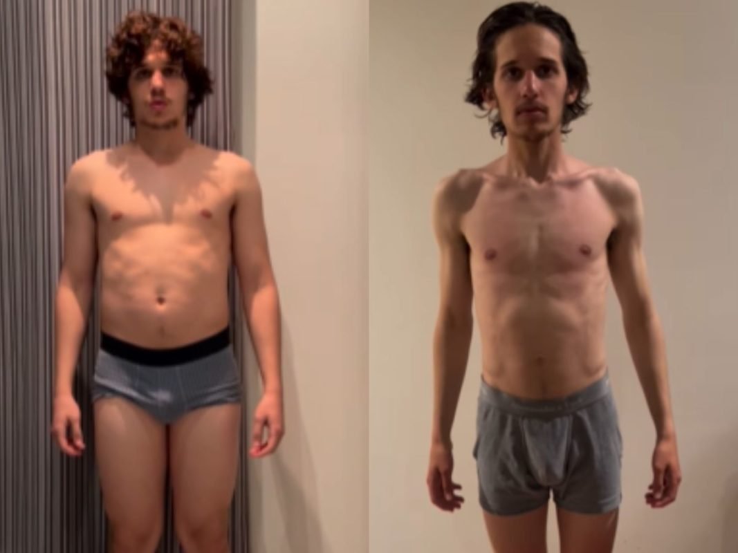 Homem saudável e homem excessivamente magro - Antes e depois de Andy Pruss durante gravações de A Sociedade da Neve - Metrópoles