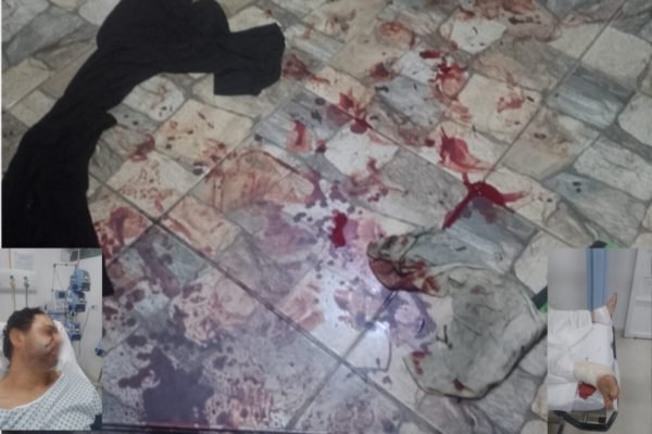 Foto colorida de chão de azulejos brancos e cinjas manchados com sangue - Metrópoles