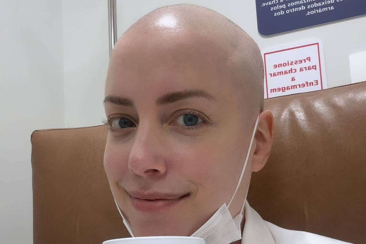 foto colorida do rosto de Fabiana Justus careca - metrópoles