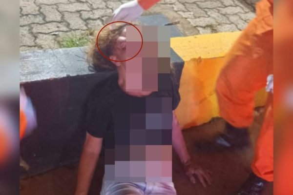 Imagem colorida de uma mulher com a cabeça machucada- Metrópoles
