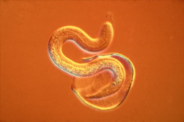 Micrografia óptica usando a técnica de Nomarski: Lombriga intestinal, Ascaris lumbricoides - juvenil eclodindo do ovo;