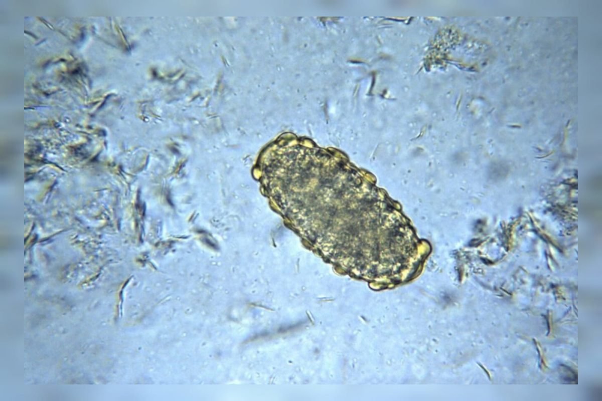 Esta micrografia revela um ovo não fertilizado do verme redondo Ascaris lumbricoides, Mag. 400X. Os ovos fertilizados de Ascaris lumbricoides são arredondados e possuem casca grossa. Enquanto os ovos não fecundados são alongados e maiores, de casca mais fina, recobertos por uma camada mamilada mais visível, que às vezes é recoberta por protuberâncias, como neste caso.