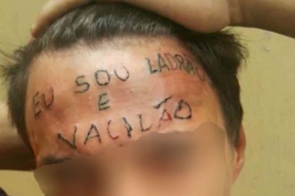Imagem colorida mostra o jovem Ruan Rocha da Silva, que teve a testa tatuada em 2017 com a frase "sou ladrão e vacilão" - Metrópoles