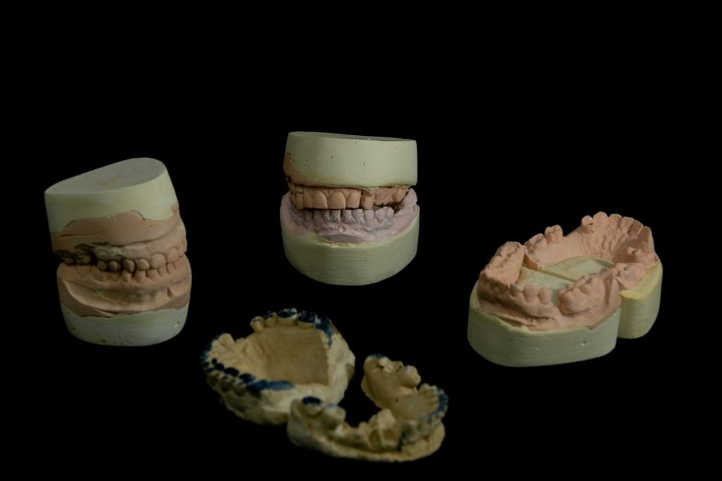arcadas dentárias